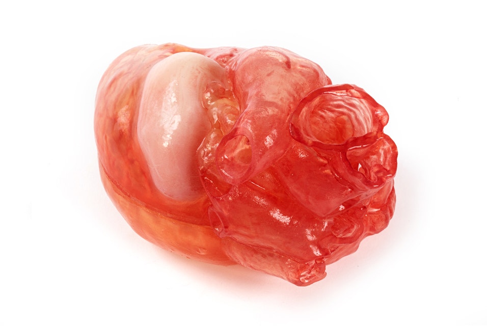 3D-printed heart model in a transparent material with a red tint