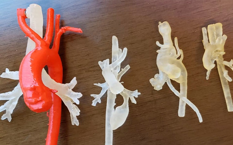 3D models of patient’s anatomy  