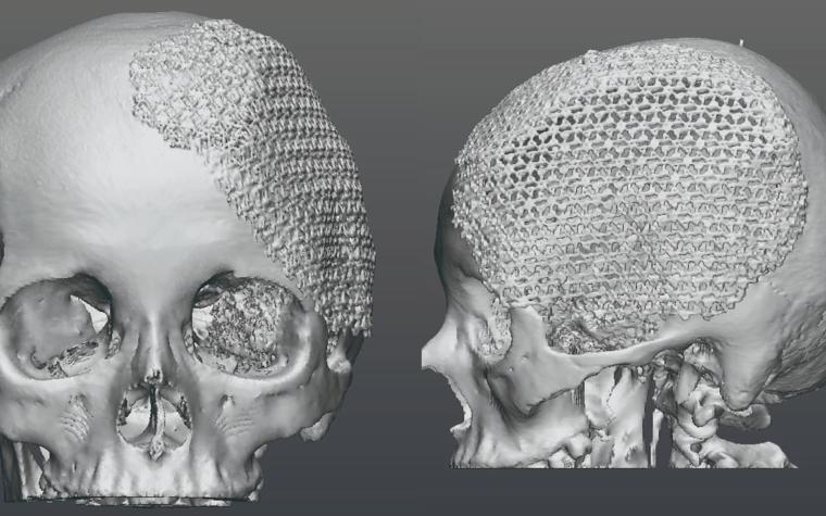 cimq-protocolo-de-estudio-ruth-antihueno-bio1.jpg