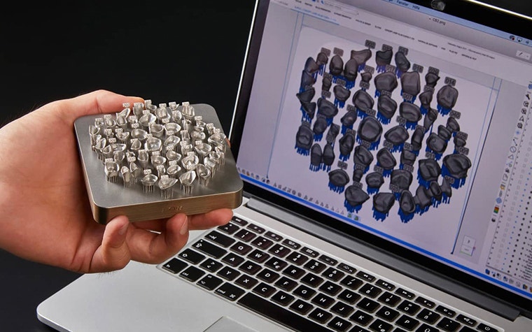 Person holding 3D-printed dental parts in front of a laptop with Magics Dental Module on it