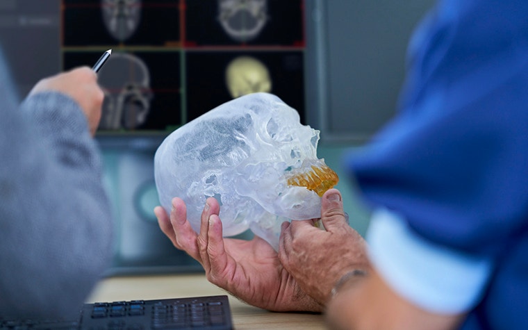 Surgeon holds a 3D-printed skull while a radiologist points to 3D models on a computer screen 