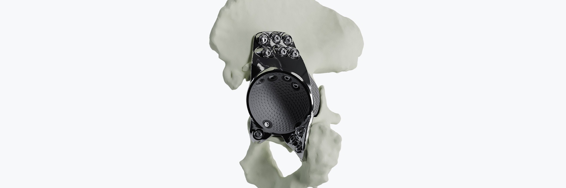 aMace hip implant in a bone model