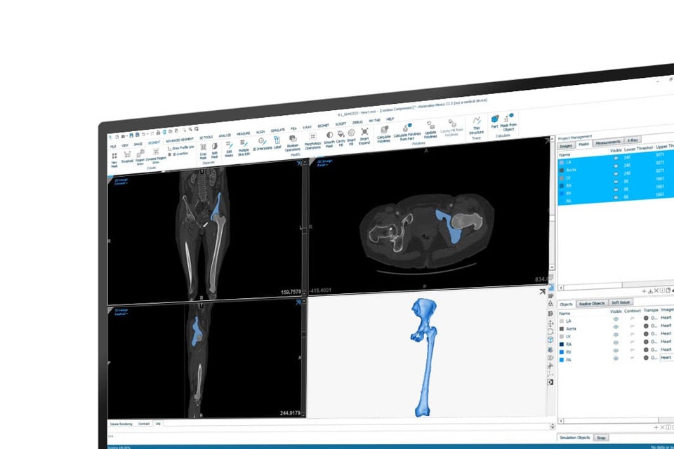 Bild der Knochenanatomie in verschiedenen digitalen Formaten in Mimics auf einem Bildschirm