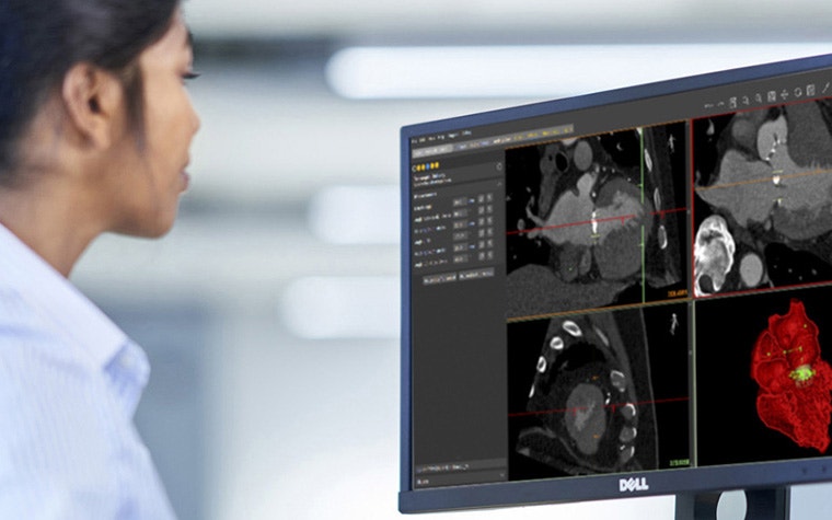 Woman looking at a computer screen with medical software displaying different views of anatomy