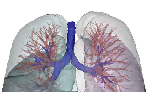 Digital image of lung anatomy