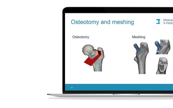 ssm-femur-model-osteotomy-meshing.jpg