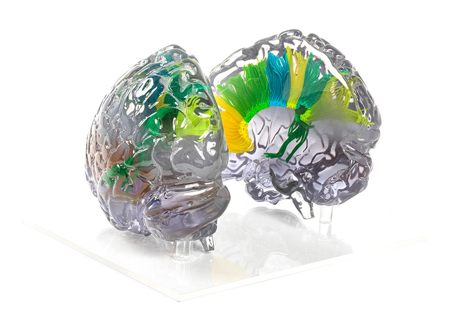 Querschnittsansicht eines 3D-gedruckten Gehirnmodells, größtenteils transparent mit einigen Abschnitten in Gelb, Grün und Blau