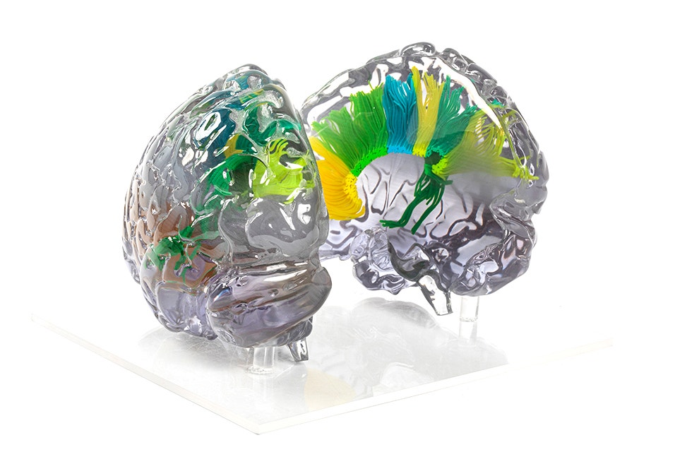 Vue en coupe d'un modèle de cerveau imprimé en 3D, majoritairement transparent avec quelques sections en jaune, vert et bleu