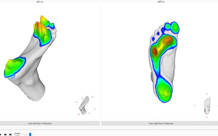 Screenshot showing digital images of footscan