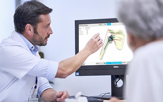 Doctor showing an elderly female patient a preoperative shoulder plan on a computer monitor