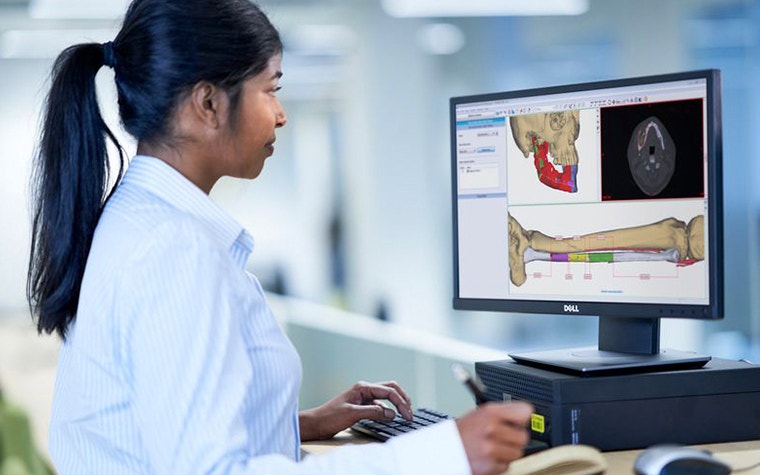 Woman sitting at computer looking at 3D models in Materialise Mimics software on the screen 