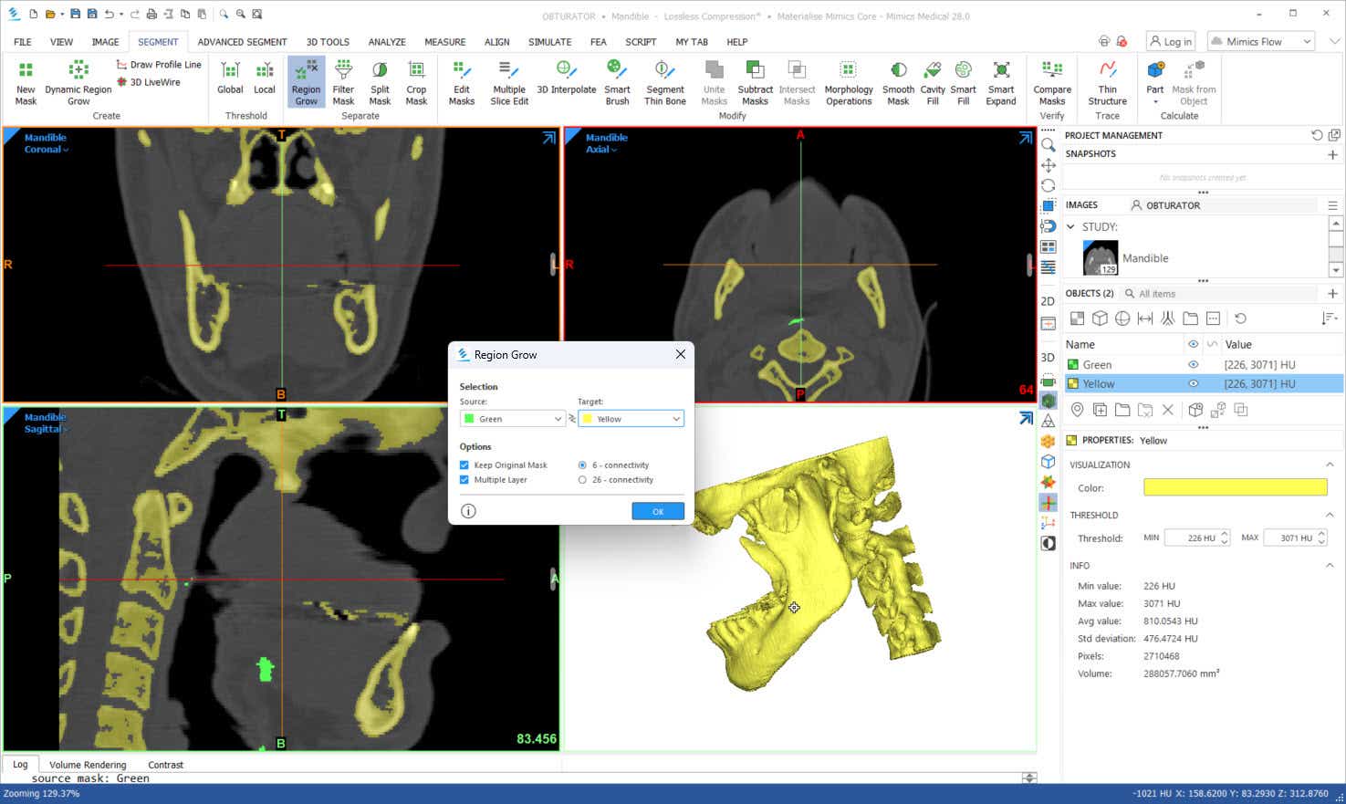 Captura de pantalla de un cuadro de crecimiento de la región en Mimics
