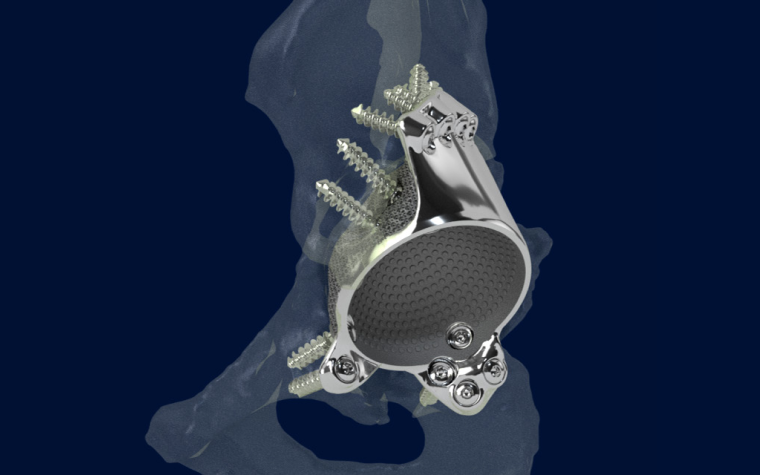 materialise-amace-hip-implant-render.jpg