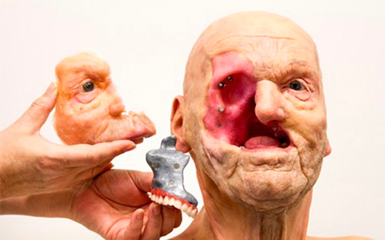 3D-printed facial parts next to a man missing parts of his face