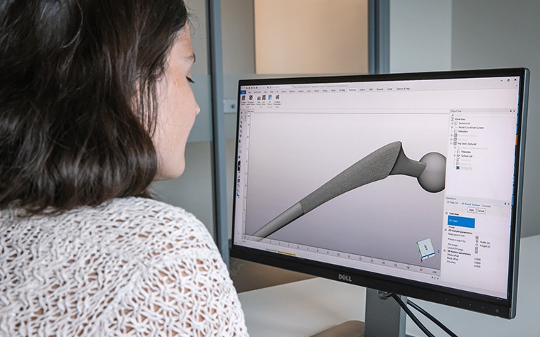 컴퓨터 화면에서 3-matic 소프트웨어로 고관절 임플란트의 가상 모델을 살펴보는 여성