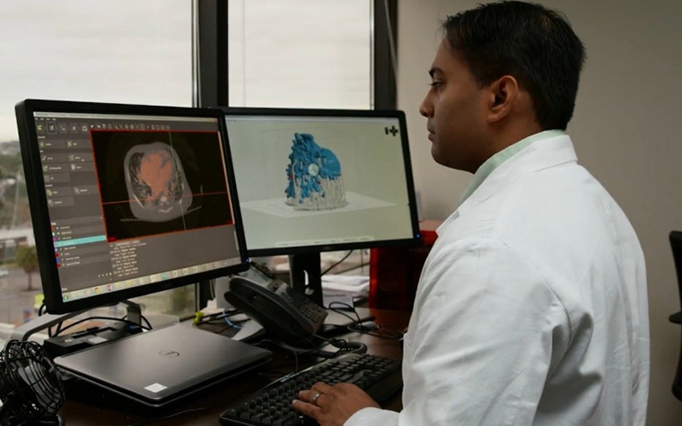 Dr. Sarkar sits at a computer to Mimics inPrint software to prepare the 3D anatomical model 