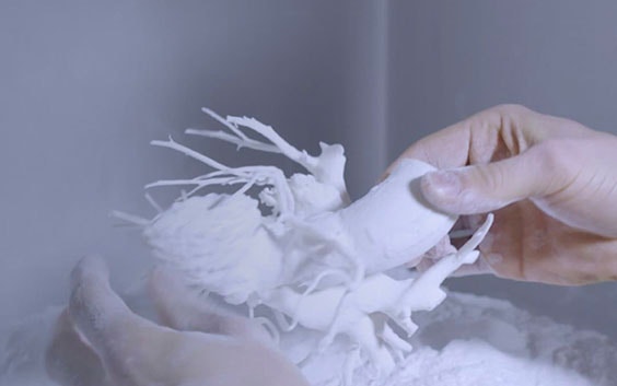 Hands removing a 3D-printed anatomical model from a powder bed