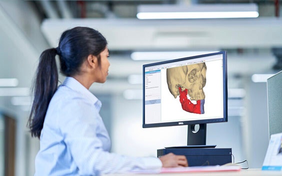 Eine medizinische Fachkraft betrachtet eine 3D-Planungssoftware auf einem Computer