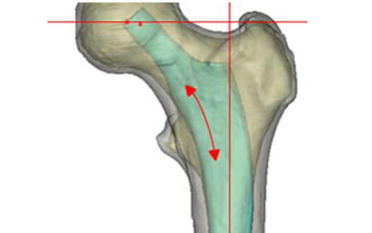 Digital image of a bone with arrows over top