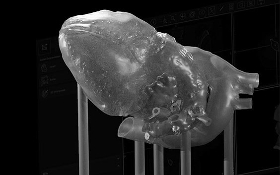 기둥으로 지탱되는 투명한 3D 프린팅 심장 모델