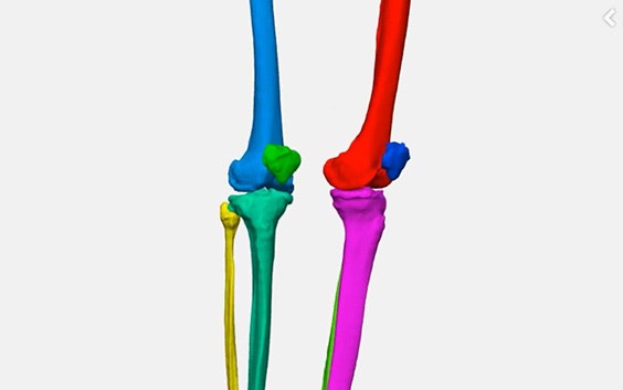 Versatility in Mimics: 3 Ways to Segment Bones