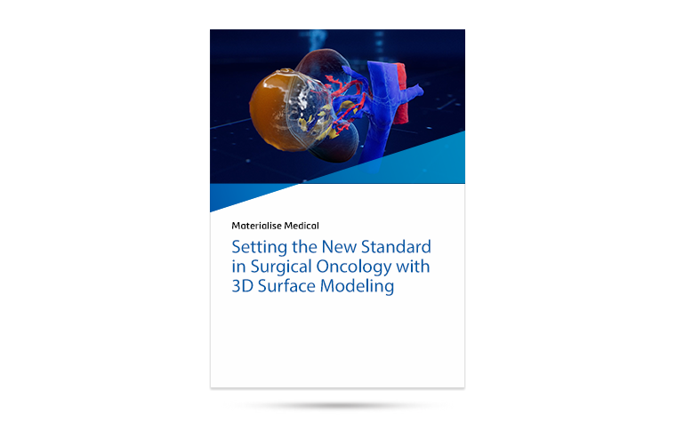 whitepaper-surgical-oncology-3d-surface-modeling.png