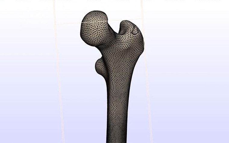 How to Prepare a Bone Model for FEA