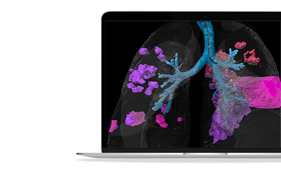 ssm-pulmonary-intervention.jpg