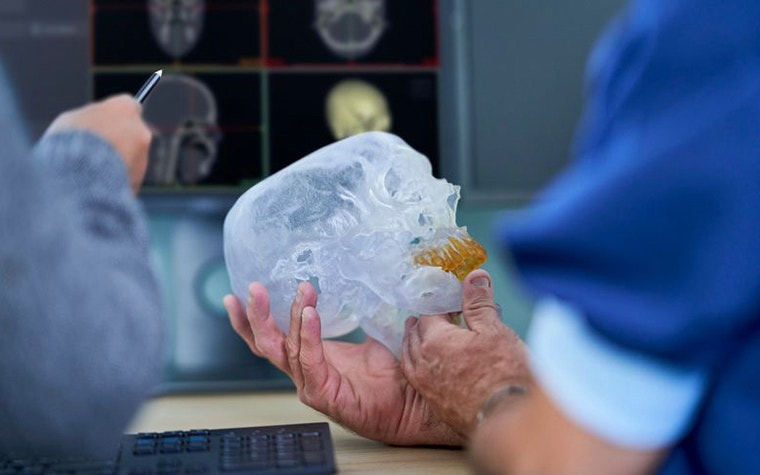 Physician holding a 3D printed anatomical model of a human skull 