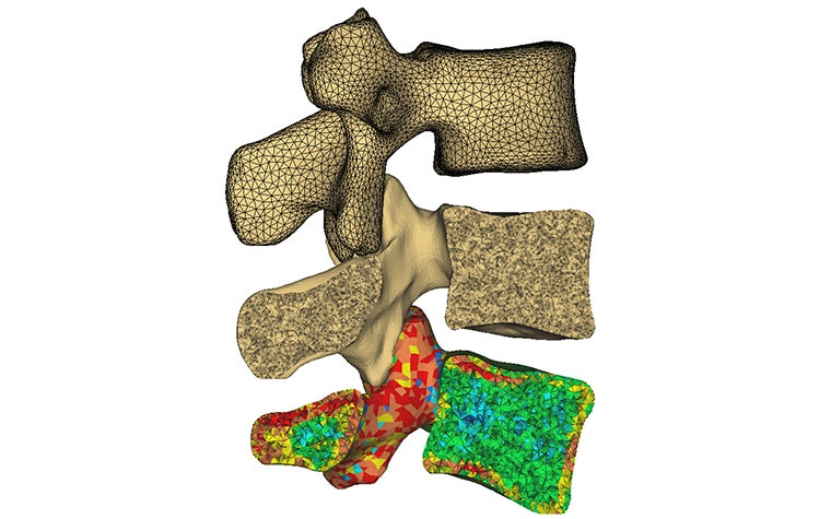 Digital 3D model of vertebrae showing different visualization techniques: wireframe mesh, solid bone texture, and a color-coded finite element analysis with red, yellow, and green stress distribution.