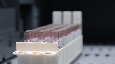 Image of tests tubes in a laboratory