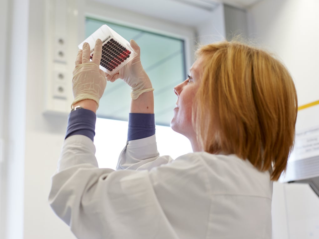 In the DKMS Life Science Lab, an employee checks a prepared blood sample panel for the correct fill level. In the DKMS Life Science Lab, an employee checks a prepared blood sample panel for the correct fill level.