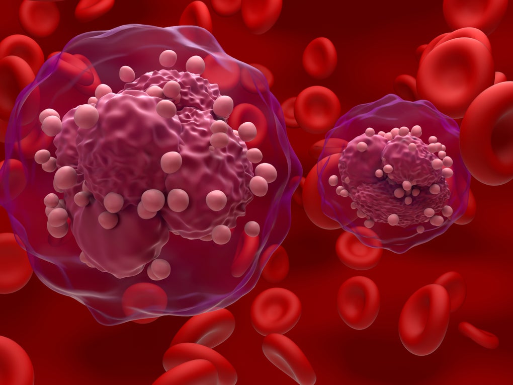 3d illustration of acute lymphoblastic leukaemia cells 3d illustration of acute lymphoblastic leukaemia cells
