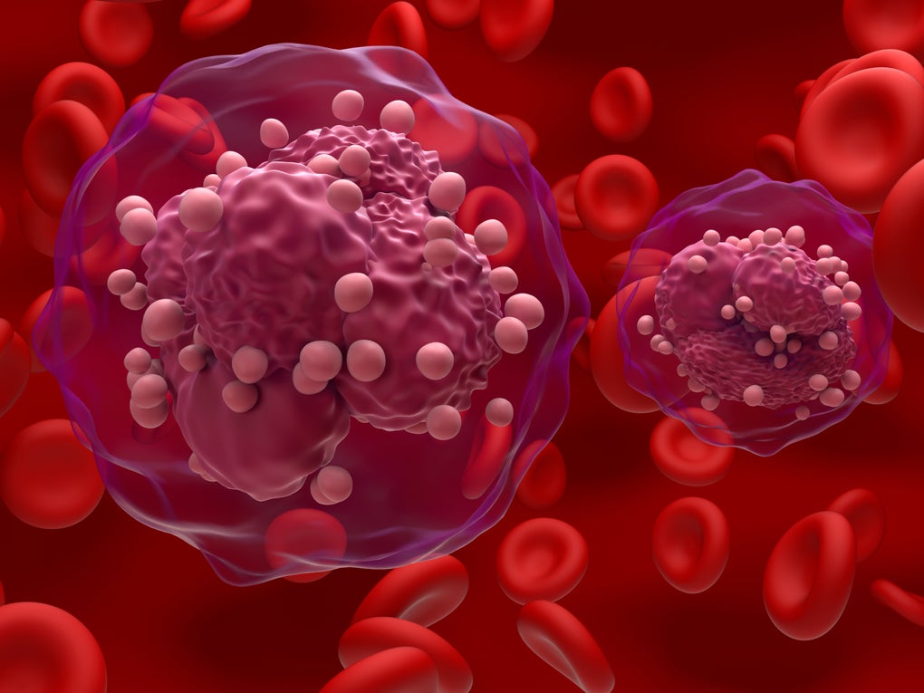 3d illustration of acute lymphoblastic leukaemia cells 3d illustration of acute lymphoblastic leukaemia cells