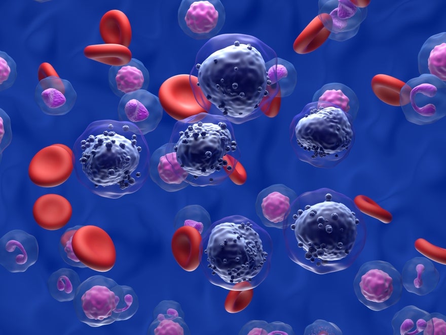 3d illustration of acute myeloid leukaemia cells 3d illustration of acute myeloid leukaemia cells