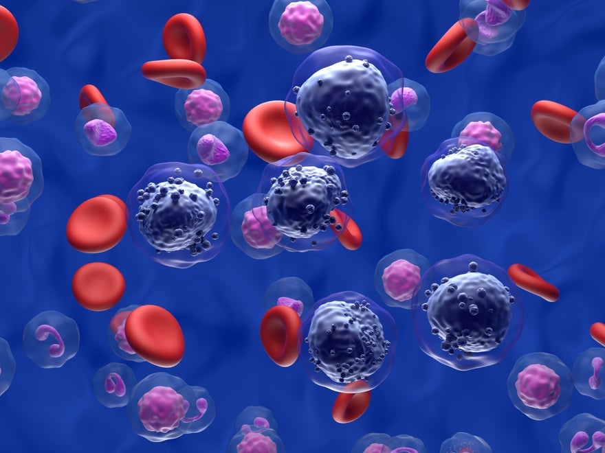3d illustration of acute myeloid leukaemia cells 3d illustration of acute myeloid leukaemia cells