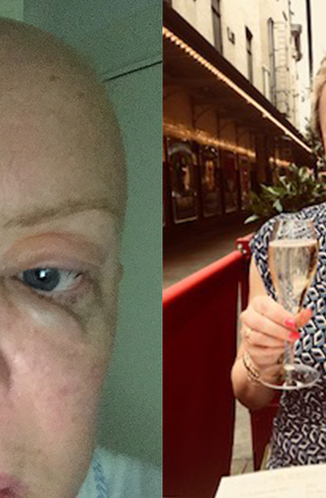 Lisa Jackson before and after AML