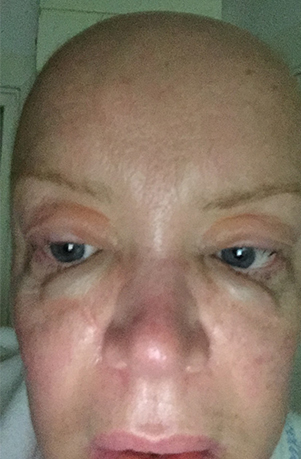 Lisa Jackson before and after AML
