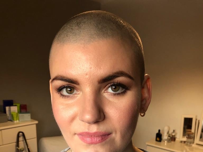 Alice Hanagan is searching for a blood stem cell donor Alice Hanagan is searching for a blood stem cell donor