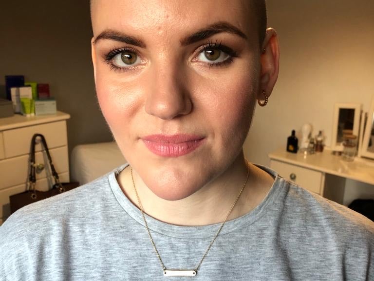 Alice Hanagan is searching for a blood stem cell donor Alice Hanagan is searching for a blood stem cell donor