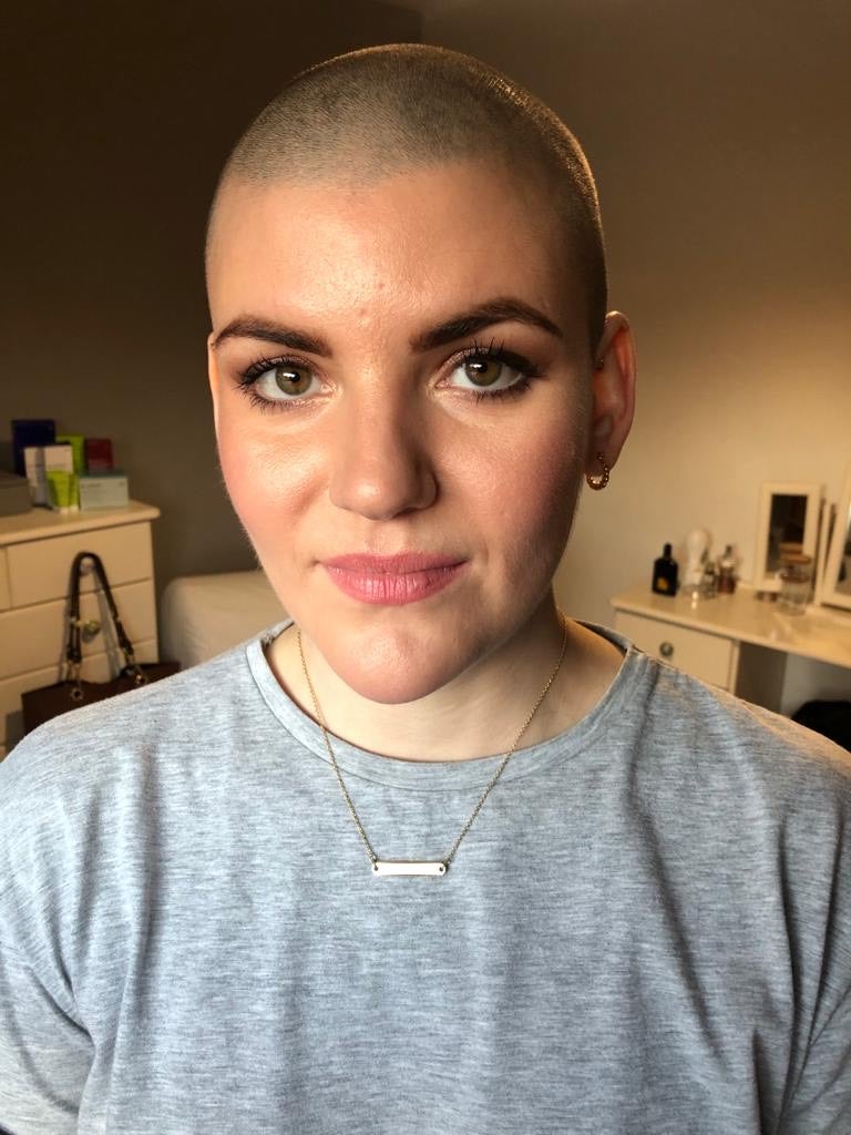 Alice Hanagan is searching for a blood stem cell donor