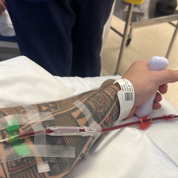 Ashley's arm showing the blood moving to the apheris machine Ashley's arm showing the blood moving to the apheris machine