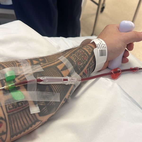 Ashley's arm showing the blood moving to the apheris machine Ashley's arm showing the blood moving to the apheris machine