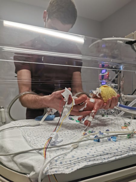 Oliver being held by his father inside an incubator
