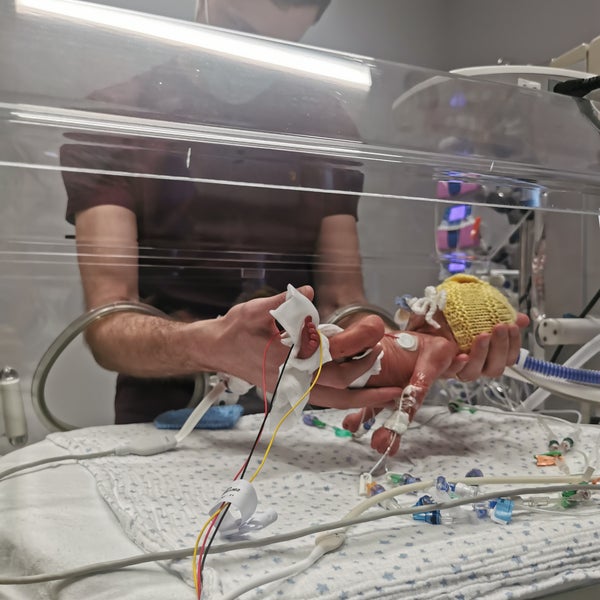 Oliver being held by his father inside an incubator