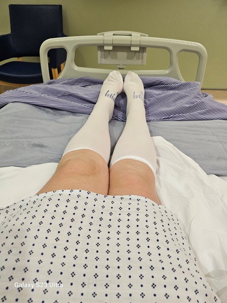 Carol's legs and feet in surgical stockings