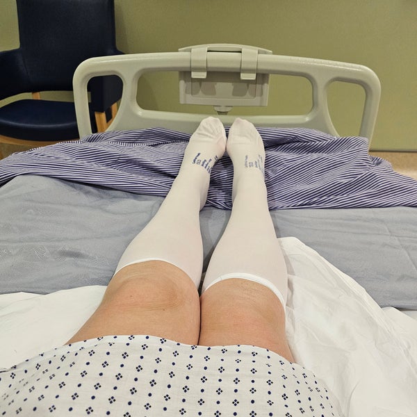 Carol's legs and feet in surgical stockings Carol's legs and feet in surgical stockings