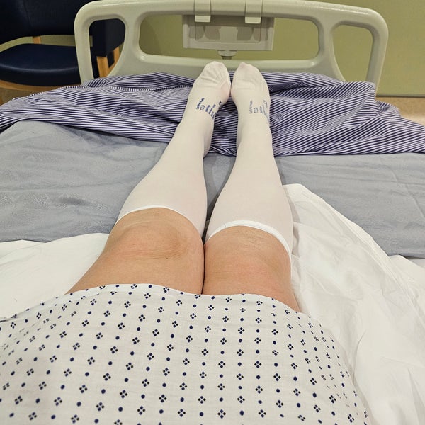 Carol's legs and feet in surgical stockings Carol's legs and feet in surgical stockings