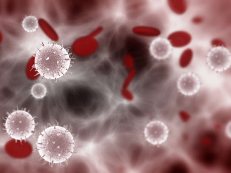 Image of leukaemia Image of leukaemia