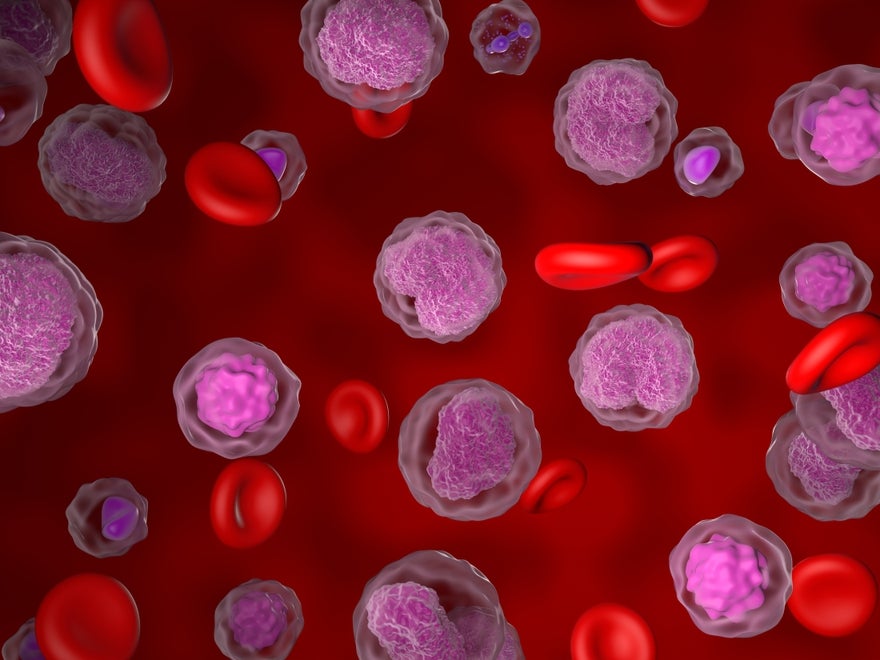 3D illustration of lymphoma 3D illustration of lymphoma